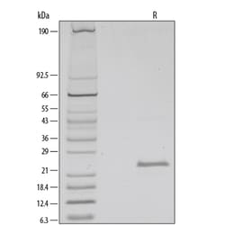 R D Systems Recombinant Human FGF-21 Protein Lyophilized from a 0.2 &mu;m filtered solution in MES, Na 2 SO 4 EDTA and DTT. | Buy Online | R&amp;D Systems&trade; | Fisher Scientific