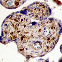Human FGF-5 Antibody, R D Systems 100&mu;g; Unlabeled:Antibodies, Polyclonal