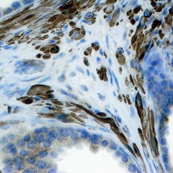 Human/Mouse FGF-8 Antibody, R D Systems 25&mu;g; Unlabeled:Antibodies,