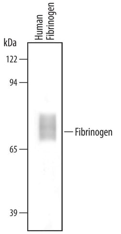 Human Fibrinogen Antibody, R D Systems 100&mu;g; Unlabeled:Antibodies,