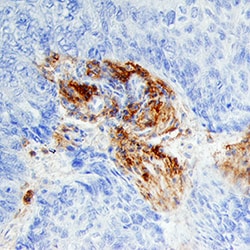 Human Fibroblast Activation Protein alpha/FAP Antibody, R D Systems 100&mu;g;