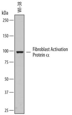 Human Fibroblast Activation Protein alpha/FAP Biotinylated Antibody, R