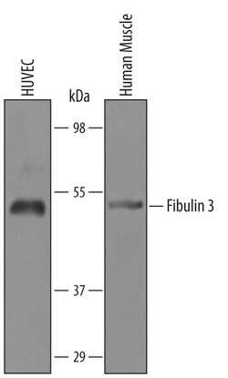 Human Fibulin 3 Antibody, R D Systems 25&mu;g; Unlabeled:Antibodies, Polyclonal