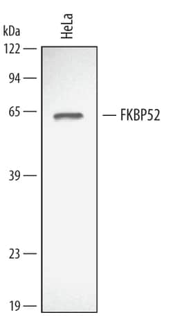 Human/Mouse/Rat FKBP52 Antibody, R D Systems 100&mu;g; Unlabeled:Antibodies,