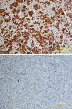 Human Follistatin Antibody, R D Systems:Antibodies:Primary Antibodies