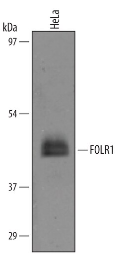 Human FOLR1 Antibody, R D Systems 100&mu;g; Unlabeled:Antibodies, Polyclonal