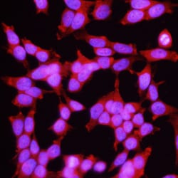 Human FOLR1 Antibody, R D Systems 25&mu;g; Unlabeled:Antibodies, Monoclonal