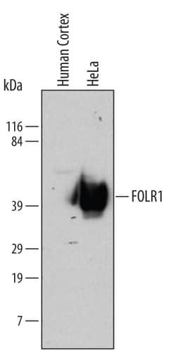 Human FOLR1 Antibody, R D Systems 25&mu;g; Unlabeled:Antibodies, Monoclonal