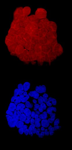 Human FOLR2 Antibody, R D Systems 100&mu;g; Unlabeled:Antibodies, Polyclonal