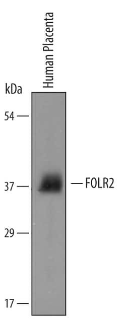 Human FOLR2 Antibody, R D Systems 100&mu;g; Unlabeled:Antibodies, Polyclonal