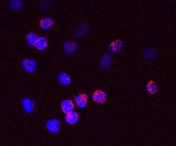Human FOLR2 Antibody, R D Systems 25&mu;g; Unlabeled:Antibodies, Monoclonal