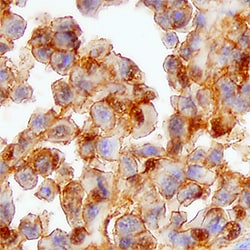 Human FOLR4 Antibody, R D Systems 25&mu;g; Unlabeled:Antibodies, Monoclonal