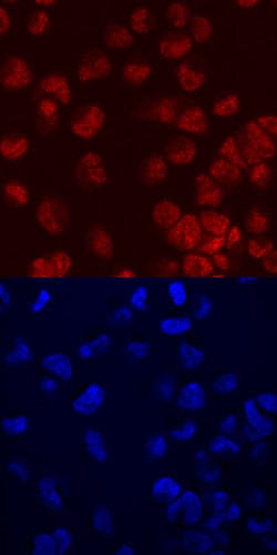Human FoxC2 Antibody, R D Systems 100ug; Unlabeled:Antibodies, Monoclonal