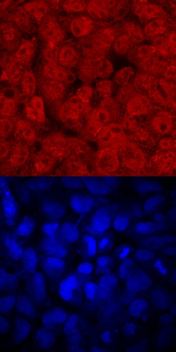 Human FoxD3 aa 1-140 Antibody, R D Systems 100&mu;g; Unlabeled:Antibodies,