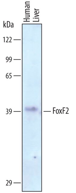 Human FoxF2 Antibody, R D Systems 25&mu;g; Unlabeled:Antibodies, Polyclonal