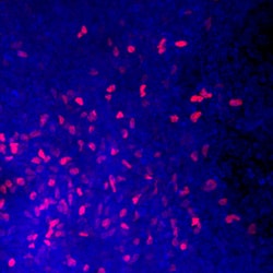 Human FoxJ1 Antibody, R D Systems 25&mu;g; Unlabeled:Antibodies, Polyclonal
