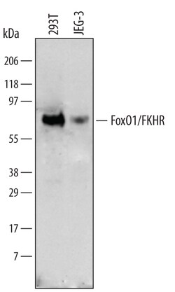 Human FoxO1/FKHR Antibody, R D Systems 25&mu;g; Unlabeled:Antibodies, Polyclonal