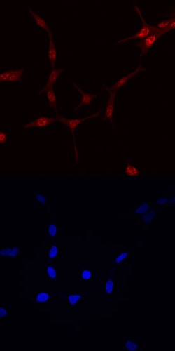 Human FoxO1/FKHR Antibody, R D Systems 25&mu;g; Unlabeled:Antibodies, Monoclonal