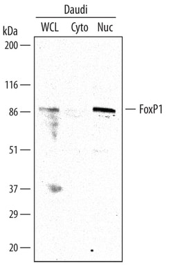 Human FoxP1 Antibody, R D Systems 25&mu;g; Unlabeled:Antibodies, Polyclonal
