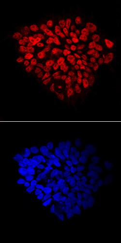 Human FoxP1 Antibody, R D Systems 100ug; Unlabeled:Antibodies, Monoclonal