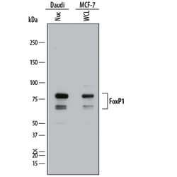 Human FoxP1 Antibody, R D Systems 100ug; Unlabeled:Antibodies, Monoclonal