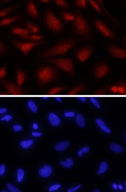 Human/Mouse FoxP2 Antibody, R D Systems 25&mu;g; Unlabeled:Antibodies,