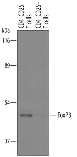 Human FoxP3 Antibody, R D Systems 25&mu;g; Unlabeled:Antibodies, Polyclonal