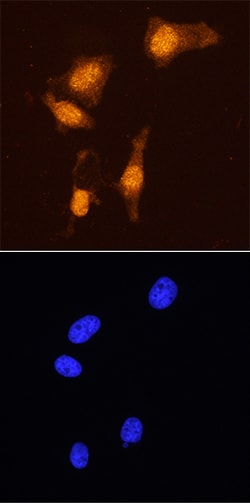 Human/Mouse FoxP3 Antibody, R D Systems 25 &mu;g; Unconjugated:Antibodies,