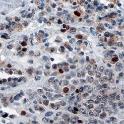 Human FRA-1 Antibody, R D Systems 100&mu;g; Unlabeled:Antibodies, Polyclonal