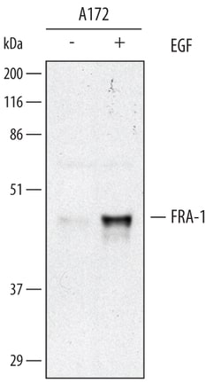 Human FRA-1 Antibody, R D Systems 100&mu;g; Unlabeled:Antibodies, Polyclonal