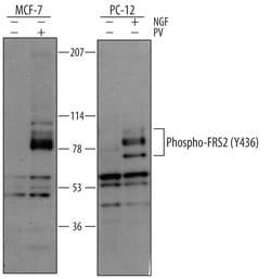 Human/Mouse/Rat Phospho-FRS2 (Y436) Antibody, R D Systems 25&mu;g; Unlabeled:Antibodies,
