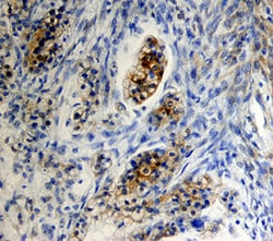 Human FSHR Antibody, R D Systems 100ug; Unlabeled:Antibodies, Monoclonal