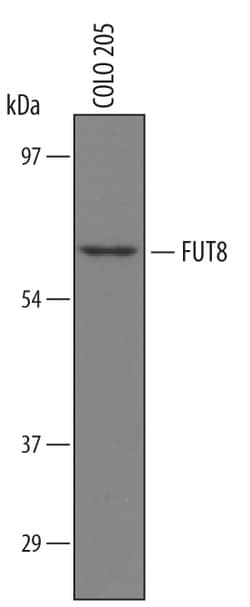 Human Fucosyltransferase 8/FUT8 Antibody, R D Systems 25&mu;g; Unlabeled:Antibodies,