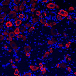 Human/Mouse/Rat GABAB R1 Antibody, R D Systems 25&mu;g; Unlabeled:Antibodies,