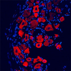 Rat GABAB R1 Antibody, R D Systems 100 &mu;g | Buy Online | R&D Systems | Fisher Scientific