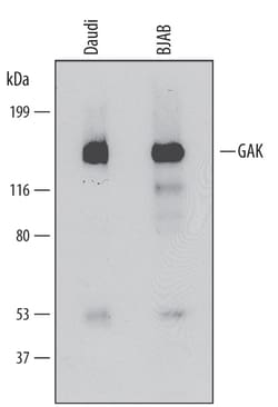 Human GAK Antibody, R D Systems 100ug; Unlabeled:Antibodies, Monoclonal