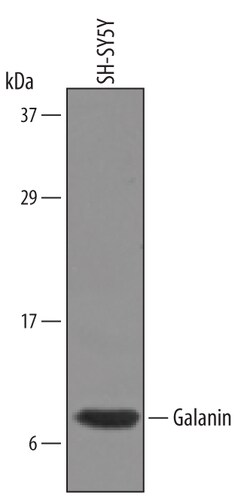 Human Galanin Antibody, R D Systems 25&mu;g; Unlabeled:Antibodies, Polyclonal