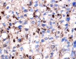 Human Galectin-1 Antibody, R D Systems 25&mu;g; Unlabeled:Antibodies, Polyclonal