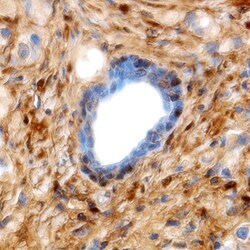 Human Galectin-1 Antibody, R D Systems 25&mu;g; Unlabeled:Antibodies, Polyclonal