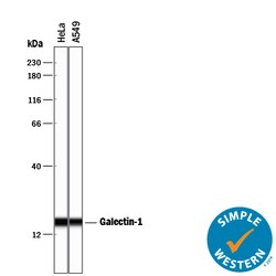 Human Galectin-1 Antibody, R D Systems 25&mu;g; Unlabeled:Antibodies, Polyclonal