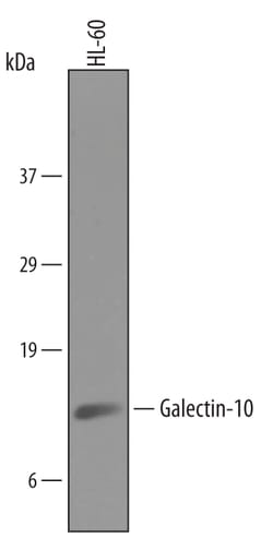 Human Galectin-10 Antibody, R D Systems 100&mu;g; Unlabeled:Antibodies,