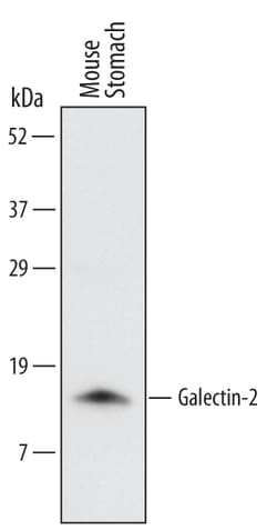 Mouse Galectin-2 Antibody, R D Systems 100&mu;g; Unlabeled:Antibodies,
