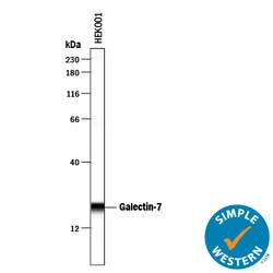 Galectin-7 Goat anti-Human, Polyclonal, R D Systems 25&mu;g; Unlabeled,