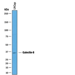 Human Galectin-8 Antibody, R D Systems 100&mu;g; Unlabeled:Antibodies,