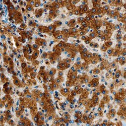 Human Polypeptide GalNAc Transferase 1/GALNT1 Antibody, R D Systems 25&mu;g;