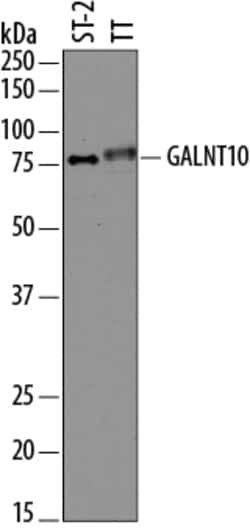 Human/Mouse Polypeptide GalNAc Transferase 10/GALNT10 Antibody, R D Systems