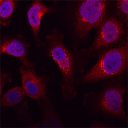 Human Polypeptide GalNAc Transferase 3/GALNT3 Antibody, R D Systems 100&mu;g;