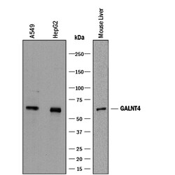 Human Polypeptide GalNAc Transferase 4/GALNT4 Antibody, R D Systems 25&mu;g;