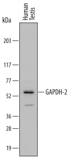 Human GAPDH-2 Antibody, R D Systems 25&mu;g; Unlabeled:Antibodies, Polyclonal
