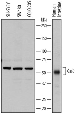 Human Gas6 Antibody, R D Systems 25&mu;g; Unlabeled:Antibodies, Polyclonal